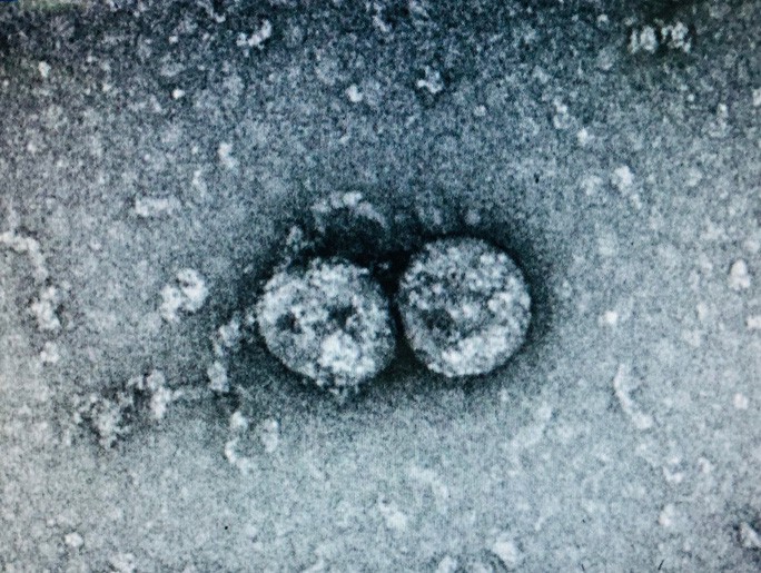 Virus gây bệnh Covid-19 ở Đà Nẵng lây lan nhanh hơn chủng cũ - Ảnh 2.