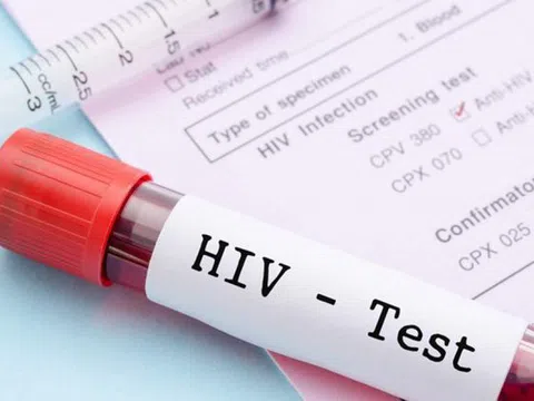 Xét nghiệm máu thông thường không thể phát hiện được HIV