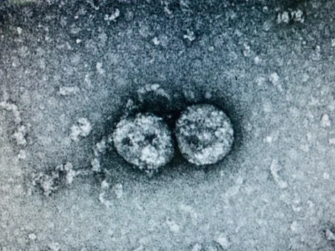 Virus gây bệnh Covid-19 ở Đà Nẵng lây lan nhanh hơn chủng cũ