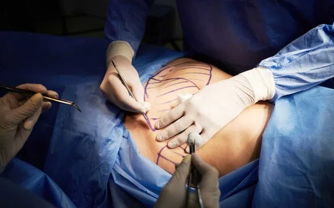 Người phụ nữ mất 6 lít máu sau hút mỡ tại Bệnh viện chuyên khoa Thẩm mỹ Đông Á