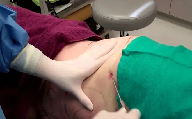 Người phụ nữ mất 6 lít máu sau hút mỡ tại Bệnh viện chuyên khoa thẩm mỹ Đông Á